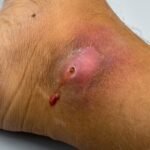 The Truth About “Minor” Injuries That Don’t Go Away