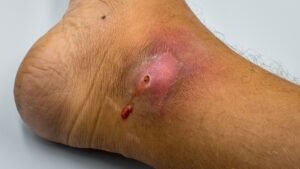 The Truth About “Minor” Injuries That Don’t Go Away